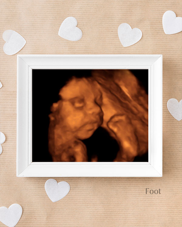 foetus 11